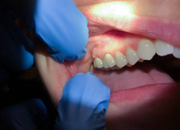 Best Pediatric Emergency Dentist in Powder Springs, GA